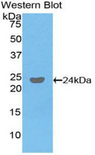 FCGR3B / CD16B Antibody - Western blot of recombinant FCGR3B / CD16B.  This image was taken for the unconjugated form of this product. Other forms have not been tested.