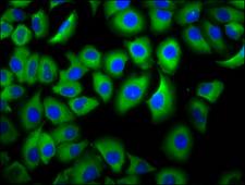 FCGR3B / CD16B Antibody - Immunofluorescence staining of A549 cells diluted at 1:66, counter-stained with DAPI. The cells were fixed in 4% formaldehyde, permeabilized using 0.2% Triton X-100 and blocked in 10% normal Goat Serum. The cells were then incubated with the antibody overnight at 4°C.The Secondary antibody was Alexa Fluor 488-congugated AffiniPure Goat Anti-Rabbit IgG (H+L).