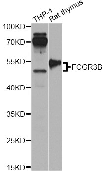 FCGR3B / CD16B Antibody - Western blot analysis of extracts of various cell lines, using FCGR3B antibody at 1:1000 dilution. The secondary antibody used was an HRP Goat Anti-Rabbit IgG (H+L) at 1:10000 dilution. Lysates were loaded 25ug per lane and 3% nonfat dry milk in TBST was used for blocking. An ECL Kit was used for detection and the exposure time was 60s.