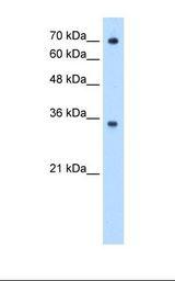 FCGRT / FCRN Antibody - HepG2 cell lysate. Antibody concentration: 0.5 ug/ml. Gel concentration: 12%.