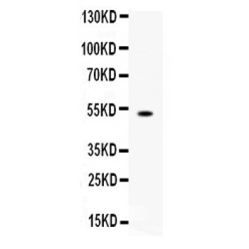 FCGRT / FCRN Antibody - Western blot analysis of FCGRT expression in mouse liver extract (lane 1). FCGRT at 50 kD was detected using rabbit anti- FCGRT Antigen Affinity purified polyclonal antibody at 0.5 ug/mL. The blot was developed using chemiluminescence (ECL) method.