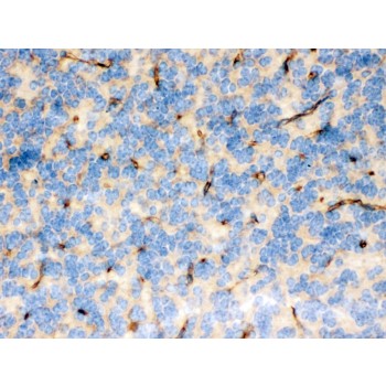 FCGRT / FCRN Antibody - FCGRT was detected in paraffin-embedded sections of mouse brain tissues using rabbit anti- FCGRT Antigen Affinity purified polyclonal antibody at 1 ug/mL. The immunohistochemical section was developed using SABC method.