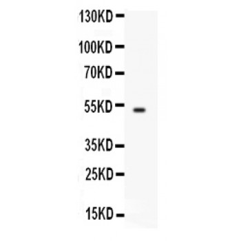 FCGRT / FCRN Antibody - Western blot analysis of FCGRT expression in A549 whole cell lysates (lane 1). FCGRT at 50 kD was detected using rabbit anti- FCGRT Antigen Affinity purified polyclonal antibody at 0.5 ug/mL. The blot was developed using chemiluminescence (ECL) method.