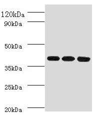 FCGRT / FCRN Antibody - Western blot All lanes: FCGRT antibody at 2µg/ml Lane 1: HepG2 whole cell lysate Lane 2: Mouse liver tissue Lane 3: A549 whole cell lysate Secondary Goat polyclonal to rabbit IgG at 1/10000 dilution Predicted band size: 40 kDa Observed band size: 40 kDa