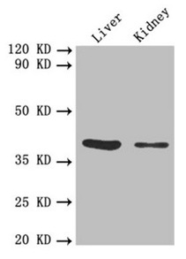 FCGRT / FCRN Antibody - Western blot All lanes: FCGRT antibody at 5.3 µg/ml Lane 1: Mouse liver tissue Lane 2: Mouse kidney tissue Secondary Goat polyclonal to rabbit IgG at 1/10000 dilution Predicted band size: 40 kDa Observed band size: 40 kDa