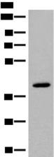 FCGRT / FCRN Antibody - Western blot analysis of Human placenta tissue lysate  using FCGRT Polyclonal Antibody at dilution of 1:400