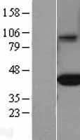 FCGRT / FCRN Protein - Western validation with an anti-DDK antibody * L: Control HEK293 lysate R: Over-expression lysate