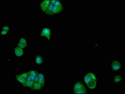 FCHO1 Antibody - Immunofluorescence staining of MCF-7 cells at a dilution of 1:100, counter-stained with DAPI. The cells were fixed in 4% formaldehyde, permeabilized using 0.2% Triton X-100 and blocked in 10% normal Goat Serum. The cells were then incubated with the antibody overnight at 4 °C.The secondary antibody was Alexa Fluor 488-congugated AffiniPure Goat Anti-Rabbit IgG (H+L) .