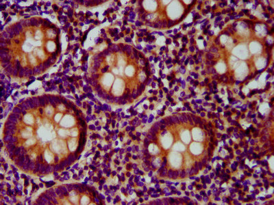 FCHO1 Antibody - Immunohistochemistry image at a dilution of 1:300 and staining in paraffin-embedded human appendix tissue performed on a Leica BondTM system. After dewaxing and hydration, antigen retrieval was mediated by high pressure in a citrate buffer (pH 6.0) . Section was blocked with 10% normal goat serum 30min at RT. Then primary antibody (1% BSA) was incubated at 4 °C overnight. The primary is detected by a biotinylated secondary antibody and visualized using an HRP conjugated SP system.