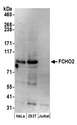 FCHO2 Antibody - Detection of human FCHO2 by western blot. Samples: Whole cell lysate (50 µg) from HeLa, HEK293T, and Jurkat cells prepared using NETN lysis buffer. Antibodies: Affinity purified rabbit anti-FCHO2 antibody used for WB at 0.1 µg/ml. Detection: Chemiluminescence with an exposure time of 3 minutes.