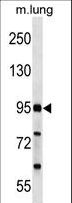 FCHO2 Antibody - FCHO2 Antibody western blot of mouse lung tissue lysates (35 ug/lane). The FCHO2 antibody detected the FCHO2 protein (arrow).