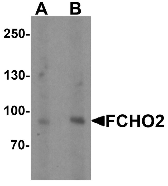 FCHO2 Antibody - Western blot analysis of FCHO2 in rat heart tissue lysate with FCHO2 antibody at (A) 1 and (B) 2 ug/ml