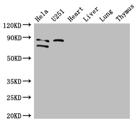 FCHO2 Antibody - Positive WB detected in:Hela whole cell lysate,U251 whole cell lysate,Mouse heart tissue,Mouse liver tissue,Mouse lung tissue,Mouse thymus tissue;All lanes: FCHO2 antibody at 3ug/ml;Secondary;Goat polyclonal to rabbit IgG at 1/50000 dilution;Predicted band size: 89,44,86 kDa;Observed band size: 89,86 kDa;