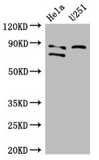 FCHO2 Antibody - Western Blot Positive WB detected in: Hela whole cell lysate, U251 whole cell lysate, Mouse heart tissue, Mouse liver tissue, Mouse lung tissue, Mouse thymus tissue All lanes: FCHO2 antibody at 3µg/ml Secondary Goat polyclonal to rabbit IgG at 1/50000 dilution Predicted band size: 89, 44, 86 kDa Observed band size: 89, 86 kDa