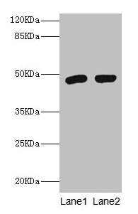 FCMR / FAIM3 Antibody - Western blot All lanes: Fas apoptotic inhibitory molecule 3 antibody at 2µg/ml Lane 1: Rat spleen tissue Lane 2: Rat kidney tissue Secondary Goat polyclonal to rabbit IgG at 1/10000 dilution Predicted band size: 47 kDa Observed band size: 47 kDa