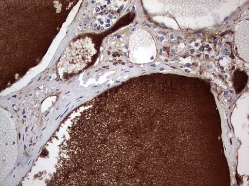 FCMR / FAIM3 Antibody - IHC of paraffin-embedded Human thyroid tissue using anti-FAIM3 mouse monoclonal antibody. (Heat-induced epitope retrieval by 1 mM EDTA in 10mM Tris, pH8.5, 120°C for 3min).