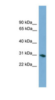 FCN1 / Ficolin-1 Antibody - FCN1 antibody Western blot of Placenta lysate. This image was taken for the unconjugated form of this product. Other forms have not been tested.