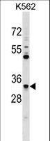 FCN1 / Ficolin-1 Antibody - FCN1 Antibody western blot of K562 cell line lysates (35 ug/lane). The FCN1 antibody detected the FCN1 protein (arrow).