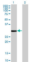FCN1 / Ficolin-1 Antibody - Western Blot analysis of FCN1 expression in transfected 293T cell line by FCN1 monoclonal antibody (M06), clone 2B7.Lane 1: FCN1 transfected lysate(35.1 KDa).Lane 2: Non-transfected lysate.