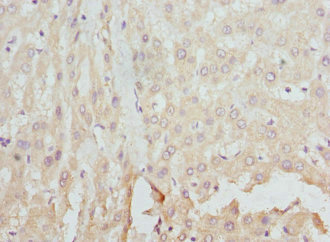 FCN1 / Ficolin-1 Antibody - Immunohistochemistry of paraffin-embedded Human liver tissue at dilution 1:100