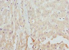 FCN1 / Ficolin-1 Antibody - Immunohistochemistry of paraffin-embedded Human liver tissue at dilution 1:100