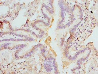 FCN1 / Ficolin-1 Antibody - Immunohistochemistry of paraffin-embedded Human lung tissue at dilution 1:100