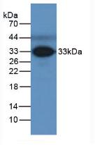 FCN3 / Ficolin-3 Antibody - Western Blot; Sample: Human Serum.