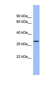 FCN3 / Ficolin-3 Antibody - FCN3 antibody Western blot of ACHN lysate. This image was taken for the unconjugated form of this product. Other forms have not been tested.