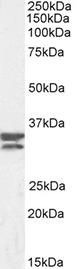FCN3 / Ficolin-3 Antibody - Anti-Human Ficolin-3 (0.3µg/ml) staining of an A549 lysate (35µg protein in RIPA buffer). Primary incubation was 1 hour. Detected by chemiluminescence.