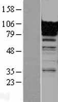FCN3 / Ficolin-3 Protein - Western validation with an anti-DDK antibody * L: Control HEK293 lysate R: Over-expression lysate