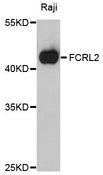 FCRL2 / IRTA4 Antibody - Western blot analysis of extracts of Raji cells, using FCRL2 antibody at 1:1000 dilution. The secondary antibody used was an HRP Goat Anti-Rabbit IgG (H+L) at 1:10000 dilution. Lysates were loaded 25ug per lane and 3% nonfat dry milk in TBST was used for blocking. An ECL Kit was used for detection and the exposure time was 1s.