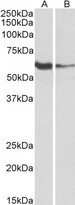 FCRL2 / IRTA4 Antibody - Goat Anti-FCRL2 (aa92-104) Antibody (1µg/ml) staining of Human Tonsil (A) and Daudi (B) lysates (35µg protein in RIPA buffer). Primary incubation was 1 hour. Detected by chemiluminescencence.