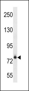 FCRL3 Antibody - FCRL3 Antibody western blot of NCI-H460 cell line lysates (35 ug/lane). The FCRL3 antibody detected the FCRL3 protein (arrow).