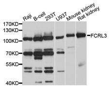 FCRL3 Antibody - Western blot analysis of extracts of various cell lines, using FCRL3 antibody at 1:1000 dilution. The secondary antibody used was an HRP Goat Anti-Rabbit IgG (H+L) at 1:10000 dilution. Lysates were loaded 25ug per lane and 3% nonfat dry milk in TBST was used for blocking. An ECL Kit was used for detection and the exposure time was 3s.
