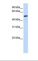 FCRL4 / IRTA1 / CD307d Antibody - Fetal brain lysate. Antibody concentration: 1.0 ug/ml. Gel concentration: 12%.  This image was taken for the unconjugated form of this product. Other forms have not been tested.