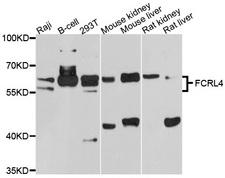 FCRL4 / IRTA1 / CD307d Antibody - Western blot analysis of extracts of various cell lines, using FCRL4 antibody at 1:1000 dilution. The secondary antibody used was an HRP Goat Anti-Rabbit IgG (H+L) at 1:10000 dilution. Lysates were loaded 25ug per lane and 3% nonfat dry milk in TBST was used for blocking. An ECL Kit was used for detection and the exposure time was 90s.