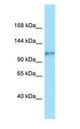 FCRL5 / CD307 Antibody - CD307 / FCRL5 antibody Western Blot of Fetal Small Intestine.  This image was taken for the unconjugated form of this product. Other forms have not been tested.