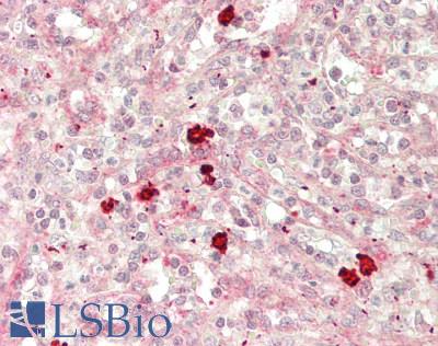 FCRL5 / CD307 Antibody - Human Spleen: Formalin-Fixed, Paraffin-Embedded (FFPE)