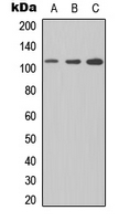 FCRL5 / CD307 Antibody - Western blot analysis of CD307e expression in Jurkat (A); NS-1 (B); PC12 (C) whole cell lysates.