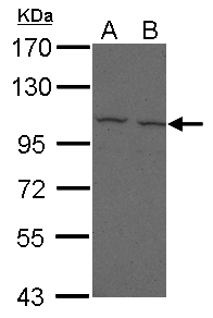 FCRL5 / CD307 Antibody - Sample (30 ug of whole cell lysate) A: 293T B: A431 7.5% SDS PAGE FCRL5 / FCRH5 antibody diluted at 1:500