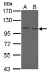 FCRL5 / CD307 Antibody - Sample (30 ug of whole cell lysate) A: 293T B: A431 7.5% SDS PAGE FCRL5 / FCRH5 antibody diluted at 1:500