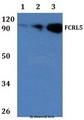 FCRL5 / CD307 Antibody - Western blot of FCRL5 antibody at 1:500 dilution Line1:Jurkat whole cell lysate Line2:PC12 whole cell lysate Line3:sp20 whole cell lysate.