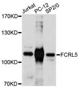 FCRL5 / CD307 Antibody - Western blot analysis of extracts of various cell lines, using FCRL5 antibody at 1:3000 dilution. The secondary antibody used was an HRP Goat Anti-Rabbit IgG (H+L) at 1:10000 dilution. Lysates were loaded 25ug per lane and 3% nonfat dry milk in TBST was used for blocking. An ECL Kit was used for detection and the exposure time was 90s.