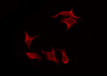 FCRL5 / CD307 Antibody - Staining HeLa cells by IF/ICC. The samples were fixed with PFA and permeabilized in 0.1% Triton X-100, then blocked in 10% serum for 45 min at 25°C. The primary antibody was diluted at 1:200 and incubated with the sample for 1 hour at 37°C. An Alexa Fluor 594 conjugated goat anti-rabbit IgG (H+L) Ab, diluted at 1/600, was used as the secondary antibody.