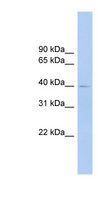FCRLA Antibody - FCRLA antibody Western blot of Fetal lung lysate. This image was taken for the unconjugated form of this product. Other forms have not been tested.