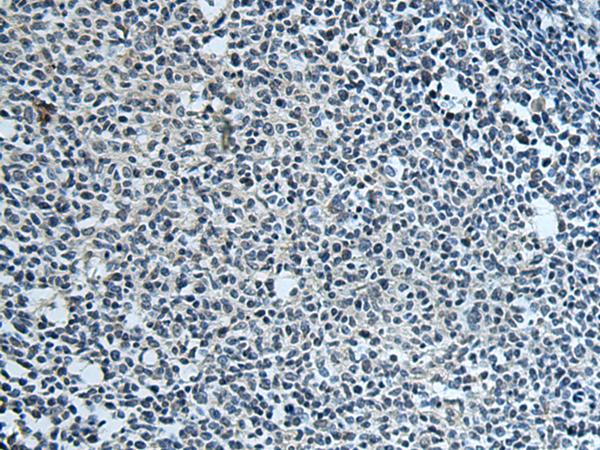 FCRLA Antibody - Immunohistochemistry of paraffin-embedded Human tonsil tissue  using FCRLA Polyclonal Antibody at dilution of 1:80(×200)
