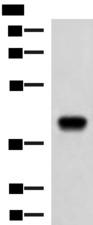 FCRLA Antibody - Western blot analysis of Ramos cell lysate  using FCRLA Polyclonal Antibody at dilution of 1:750
