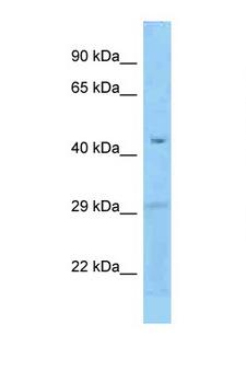 FCRLB / FREB-2 Antibody - FCRLB antibody Western blot of Fetal Liver lysate. Antibody concentration 1 ug/ml.  This image was taken for the unconjugated form of this product. Other forms have not been tested.