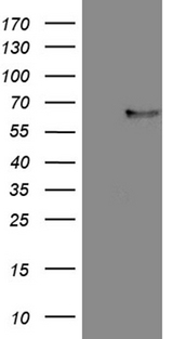 FCRLB / FREB-2 Antibody - HEK293T cells were transfected with the pCMV6-ENTRY control. (Left lane) or pCMV6-ENTRY FCRLB. (Right lane) cDNA for 48 hrs and lysed. Equivalent amounts of cell lysates. (5 ug per lane) were separated by SDS-PAGE and immunoblotted with anti-FCRLB. (1:2000)