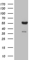 FCRLB / FREB-2 Antibody - HEK293T cells were transfected with the pCMV6-ENTRY control. (Left lane) or pCMV6-ENTRY FCRLB. (Right lane) cDNA for 48 hrs and lysed. Equivalent amounts of cell lysates. (5 ug per lane) were separated by SDS-PAGE and immunoblotted with anti-FCRLB. (1:500)
